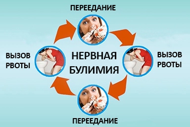 Лечение булимии в Виннице
